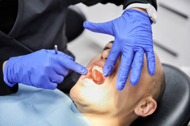 Professional Emergency Dentist in SD